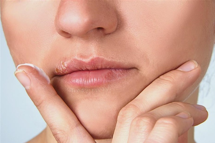 Virusas, nuo kurio nėra vaistų: kodėl reiktų vengti svetimų lūpų dažų?