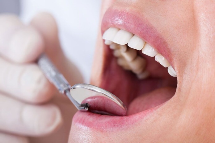 Dantų kariesą lemia tiek įgimti veiksniai, tiek jūsų gyvenimo būdas